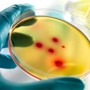 Microbial Control and Monitoring